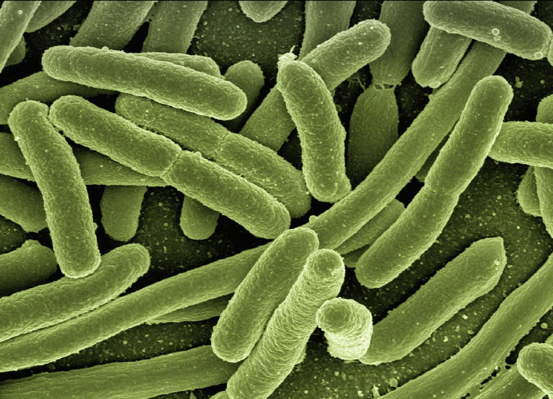 az élelmiszeriparban hasznos baktériumok